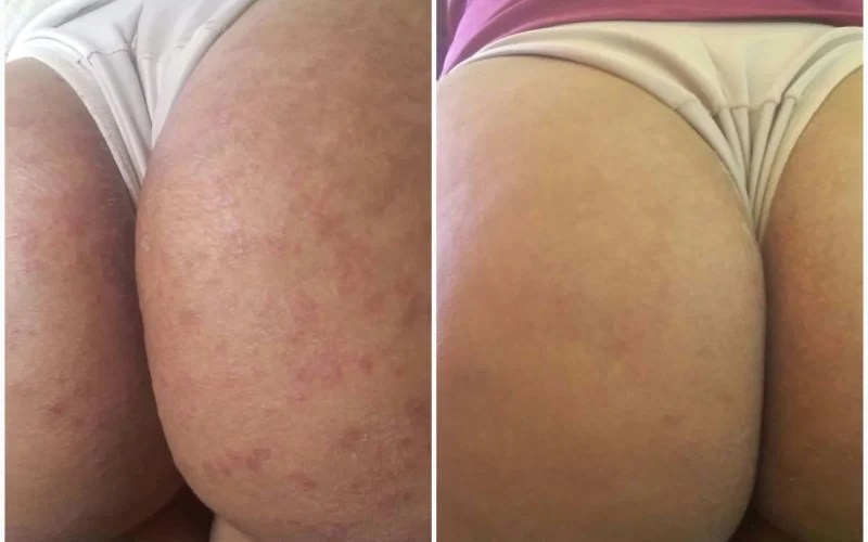 compressed_1753455381829_20181009-090635-scaled.jpg compressed_1753455381829_20181009-090635-scaled.jpg